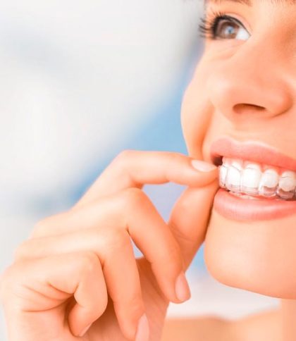 Ortodoncia Invisible